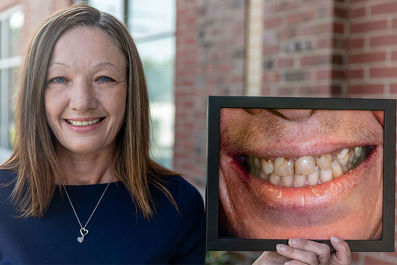 dental patient smiling